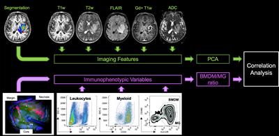 Magnetic Resonance Imaging Correlates of Immune Microenvironment in Glioblastoma